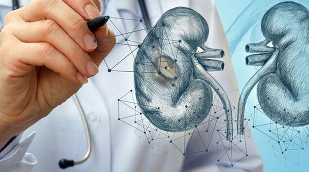 Опухоли почек