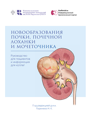 Новообразования почки, почечной лоханки и мочеточника