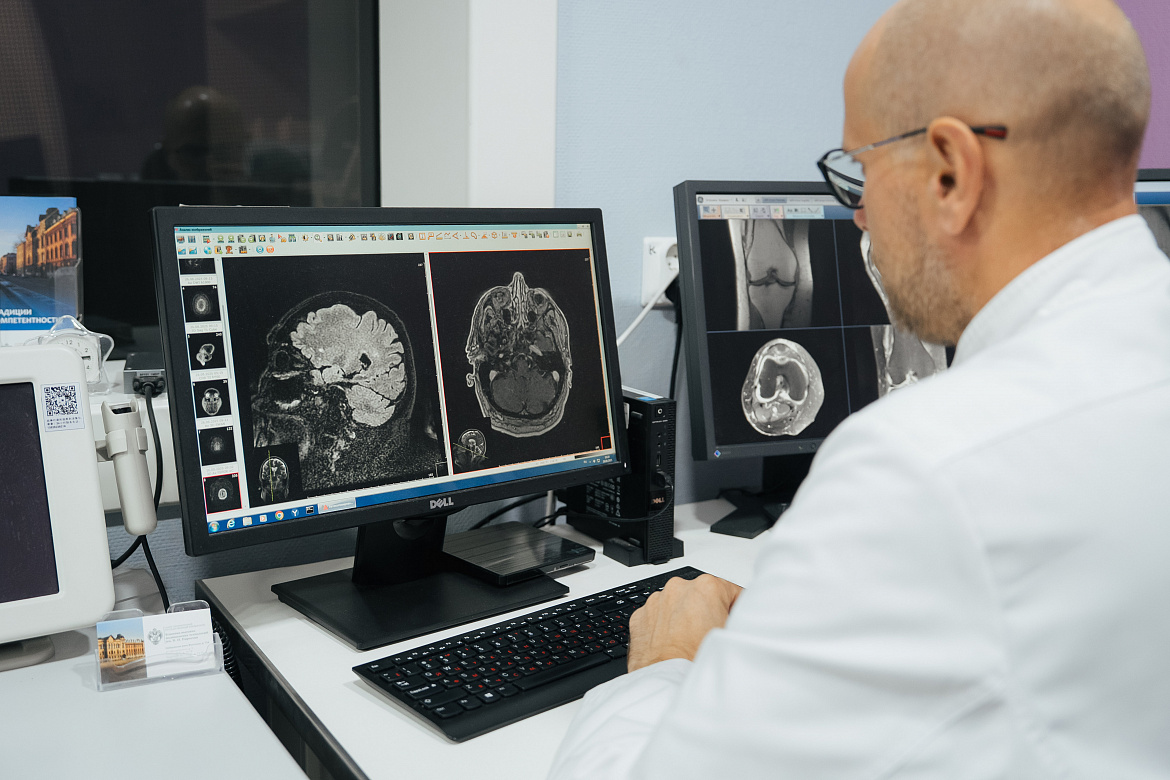 Магнитно-резонансная томография головного мозга