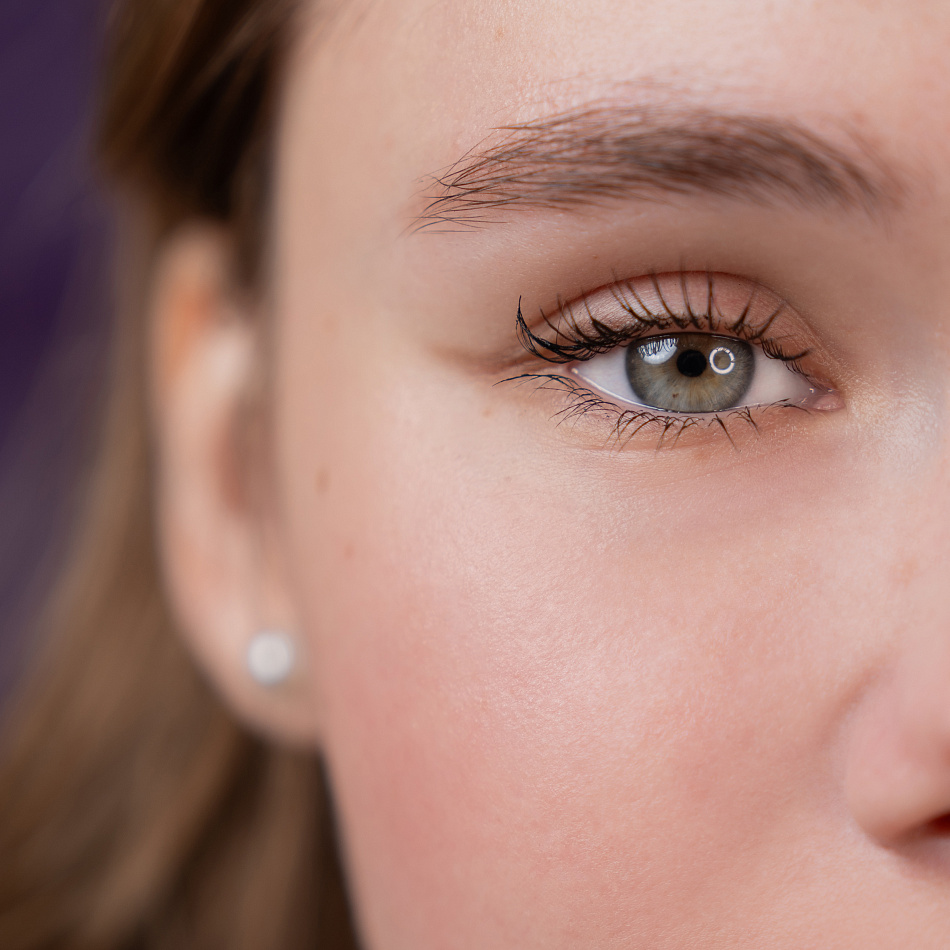 Конъюнктивит