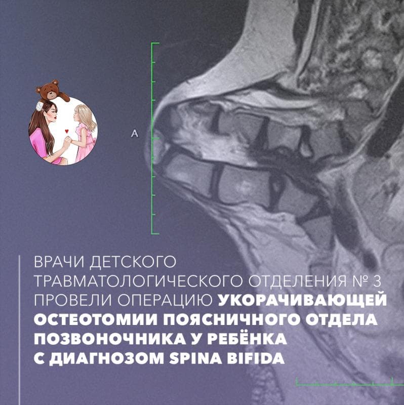 Уникальная операция проведена травматологами КВМТ им. Н. И. Пирогова СПбГУ