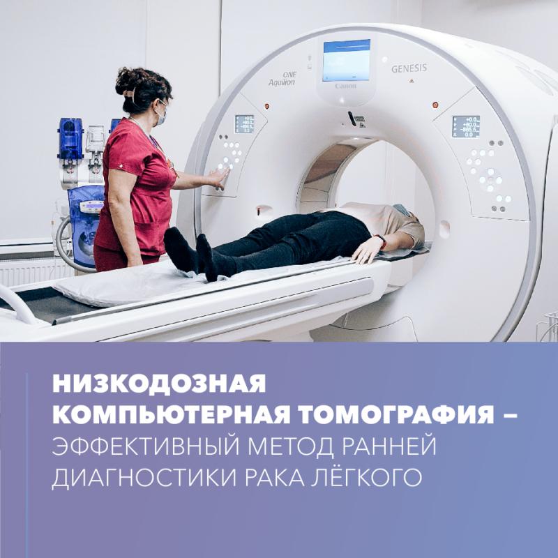 Низкодозная компьютерная томография — эффективный метод ранней диагностики рака лёгкого