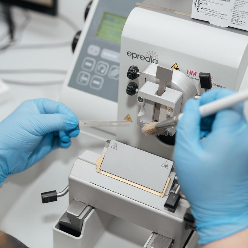 Экспресс-диагностика в Клинике СПбГУ Результат биопсии предстательной железы за одни сутки