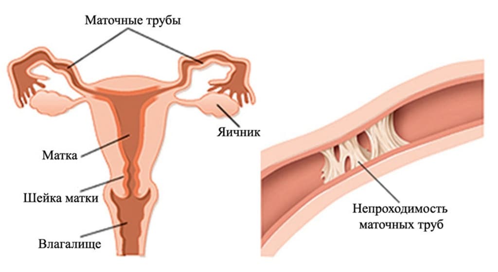 Где Находятся Яичники У Мужчины Фото