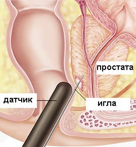 biopsia.jpg biopsia.jpg