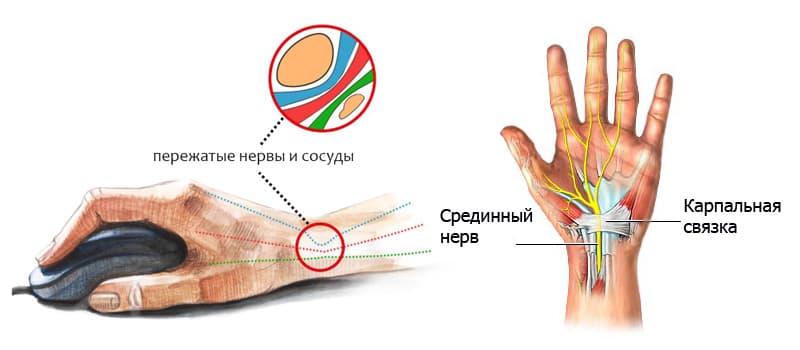 Где Находится Лучевой Нерв У Человека Фото