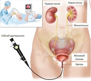 Почки У Мужчин Фото