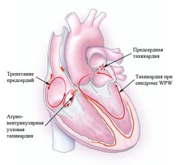 Реферат: Нарушение ритма сердца у детей