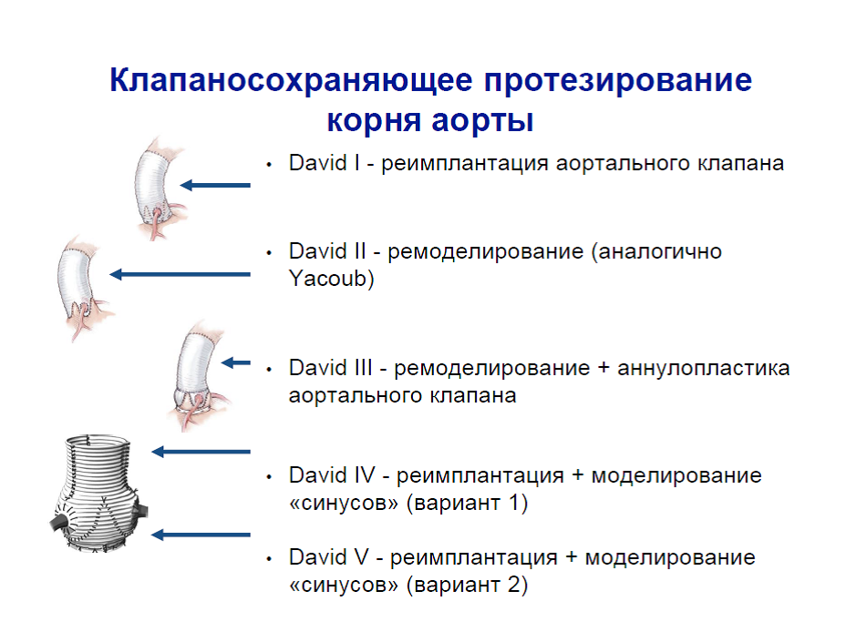 клапаносохранияющие операции.png