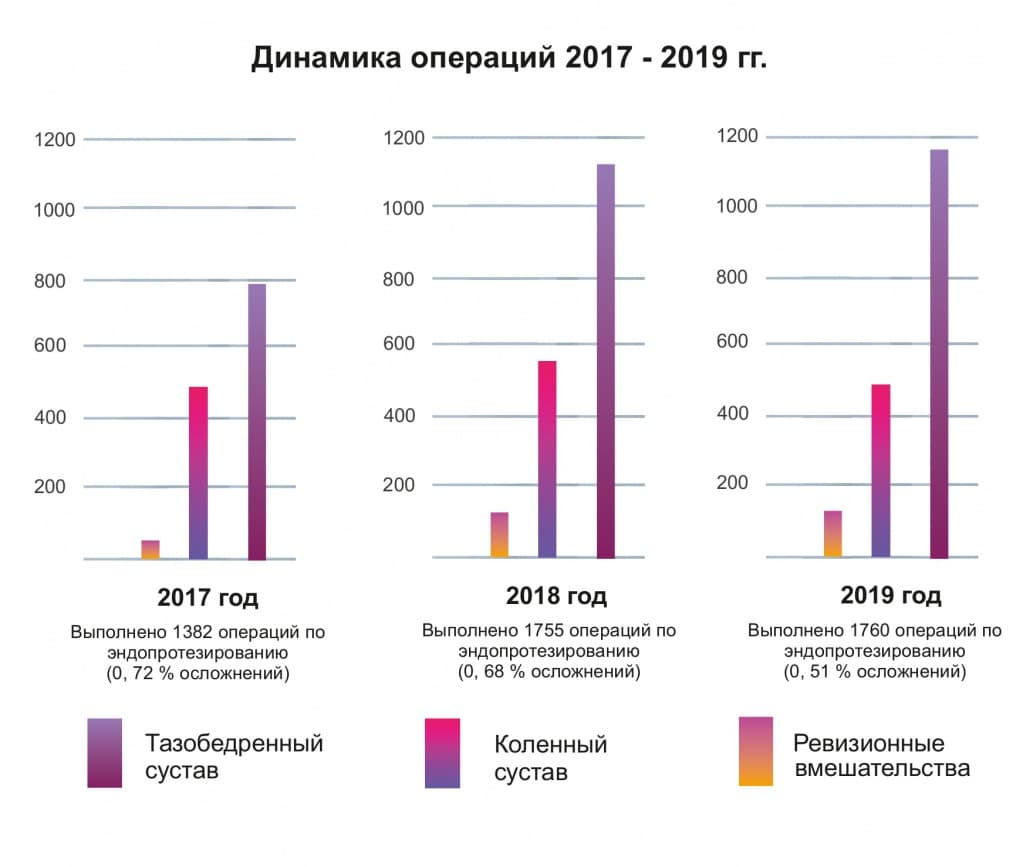 график операций