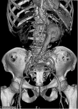 CT-Angiographie 1.jpg