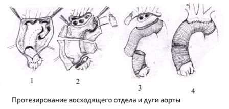 восходящийотдел.jpg