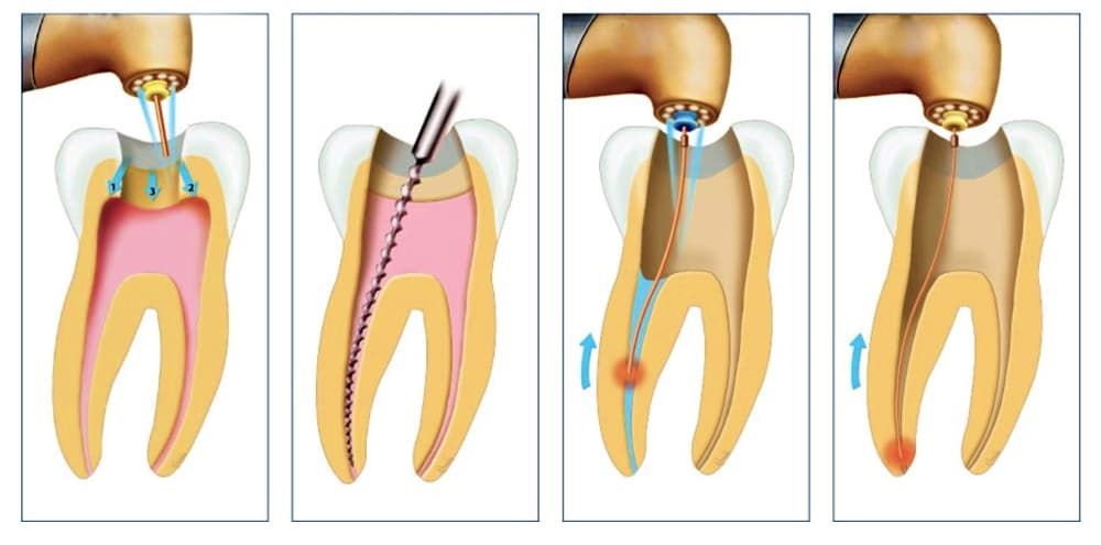 Malvern-Endodontics.jpg