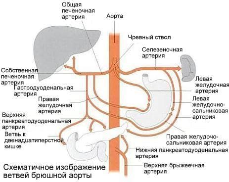 Стеноз.атеросклероз 1 .jpg