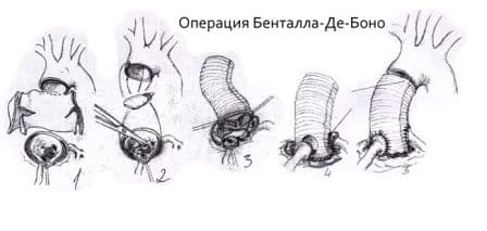боно.jpg