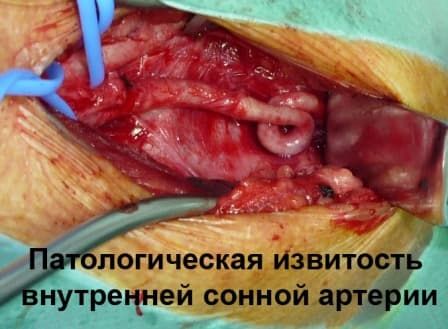 Патологическая деформация брахиоцефальных 4.jpg